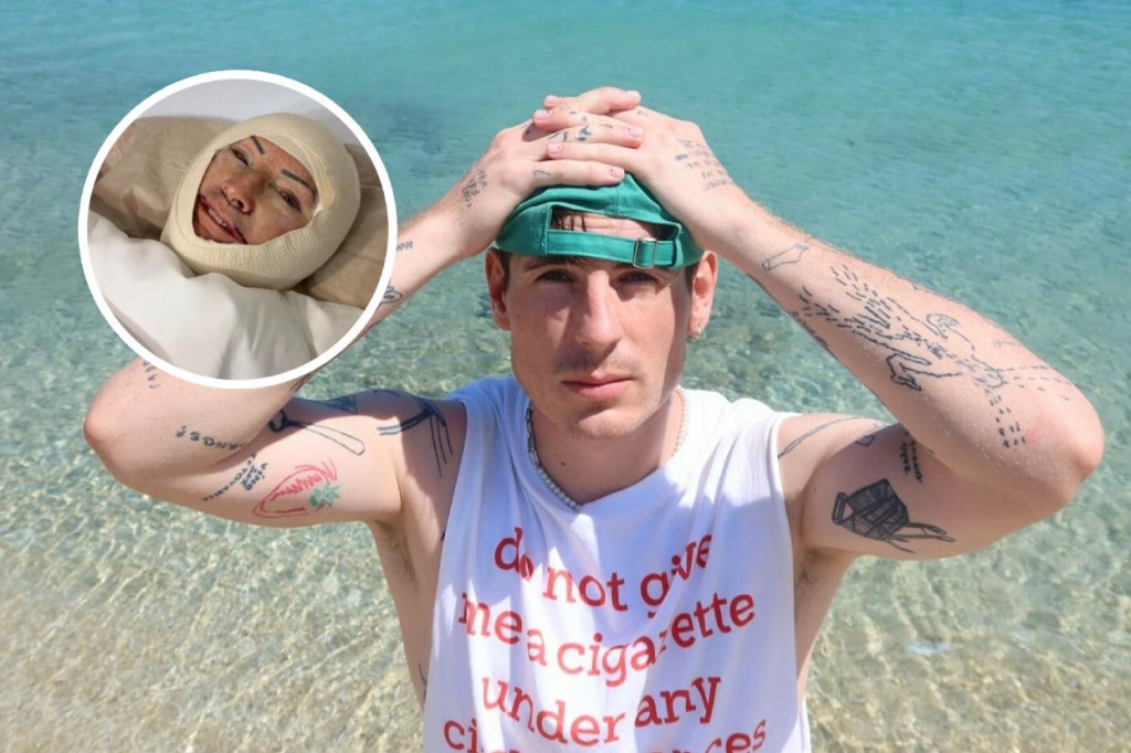 Influencer Expl0 doprial mame omladzujúcu operáciu.