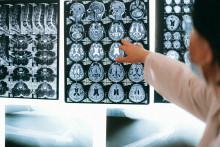 Skeny odhaľujú, čo majú mozgy psychopatov spoločné