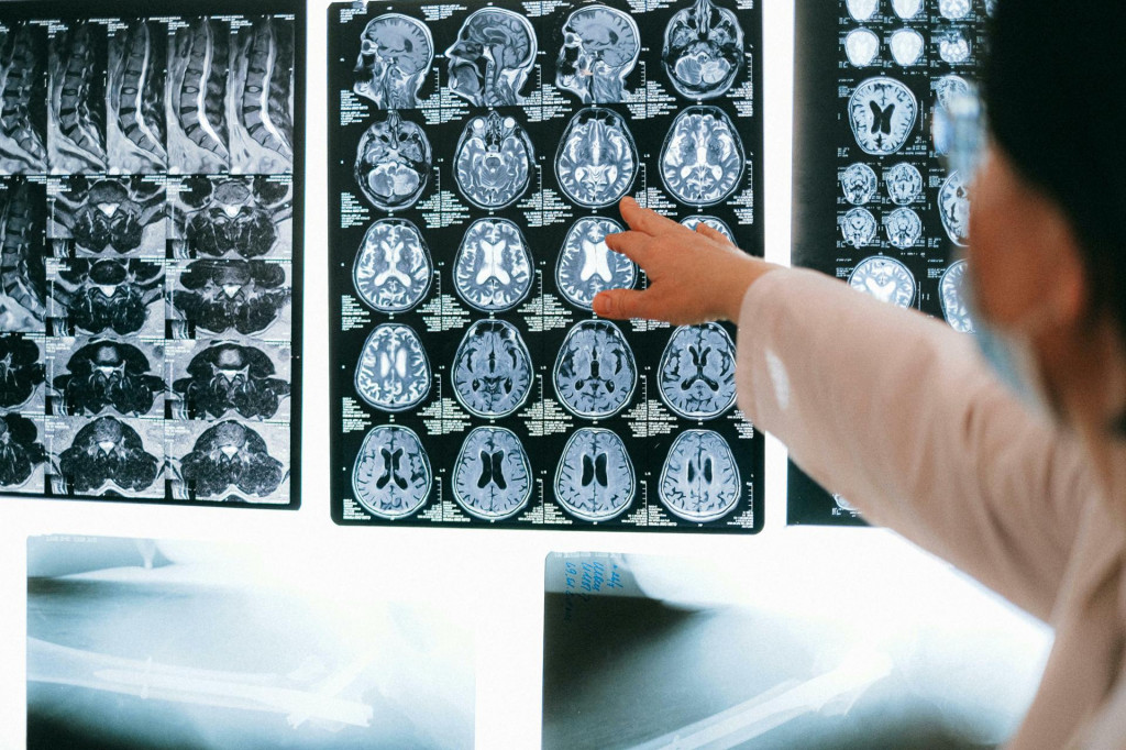 Skeny odhaľujú, čo majú mozgy psychopatov spoločné