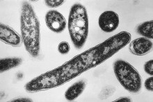 Na snímke z mikroskopu z roku 1978, ktorú sprístupnilo Centrum pre kontrolu a prevenciu chorôb, sú zobrazené baktérie Legionella pneumophila, zodpovedné za spôsobenie pľúcnej choroby známej ako legionárska choroba. FOTO: TASR/AP
