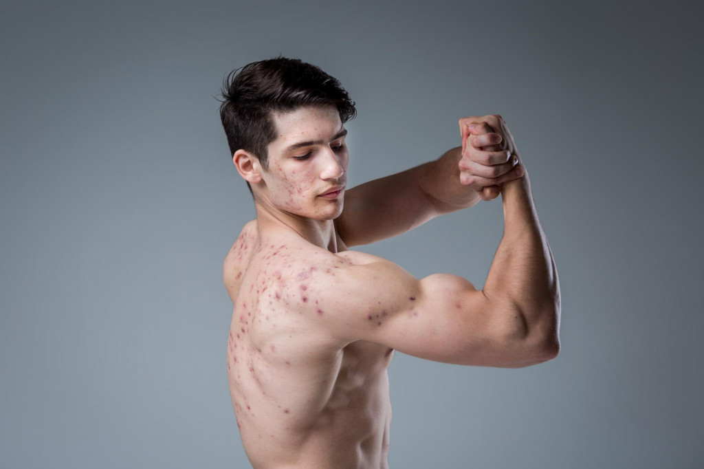 Čo je fibremaxxing a prečo je taký škodlivý?