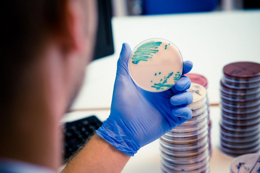 MEDIREX vyšetruje viac ako 4 000 rôznych parametrov - od biochémie cez genetiku až po špecializované mikrobiologické či imunologické vyšetrenia.