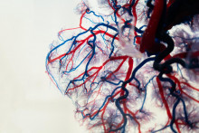 Päťdesiat percent pacientov s chronickým srdcovým zlyhávaním je mŕtvych do piatich rokov.