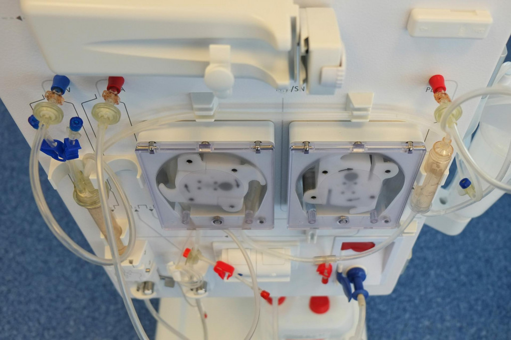 Ak obličky definit&iacute;vne vypovedia svoju funkciu, krv mus&iacute; byť filtrovan&aacute; prostredn&iacute;ctvom pravideln&yacute;ch dialyzačn&yacute;ch proced&uacute;r.