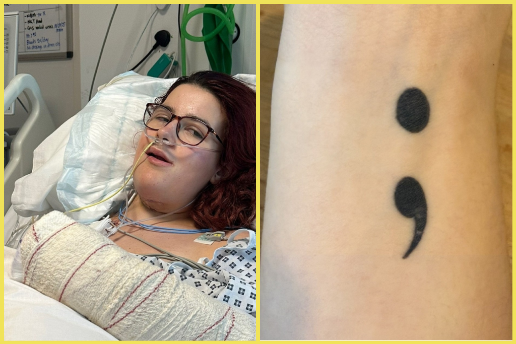 Harriet lekári pri rekonštrukcii jazyka preniesli na spodnú stranu úst jej tetovanie