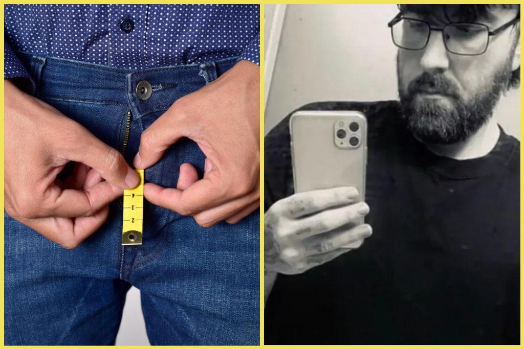 Michael tvrd&iacute;, že m&aacute; najmen&scaron;&iacute; penis na svete