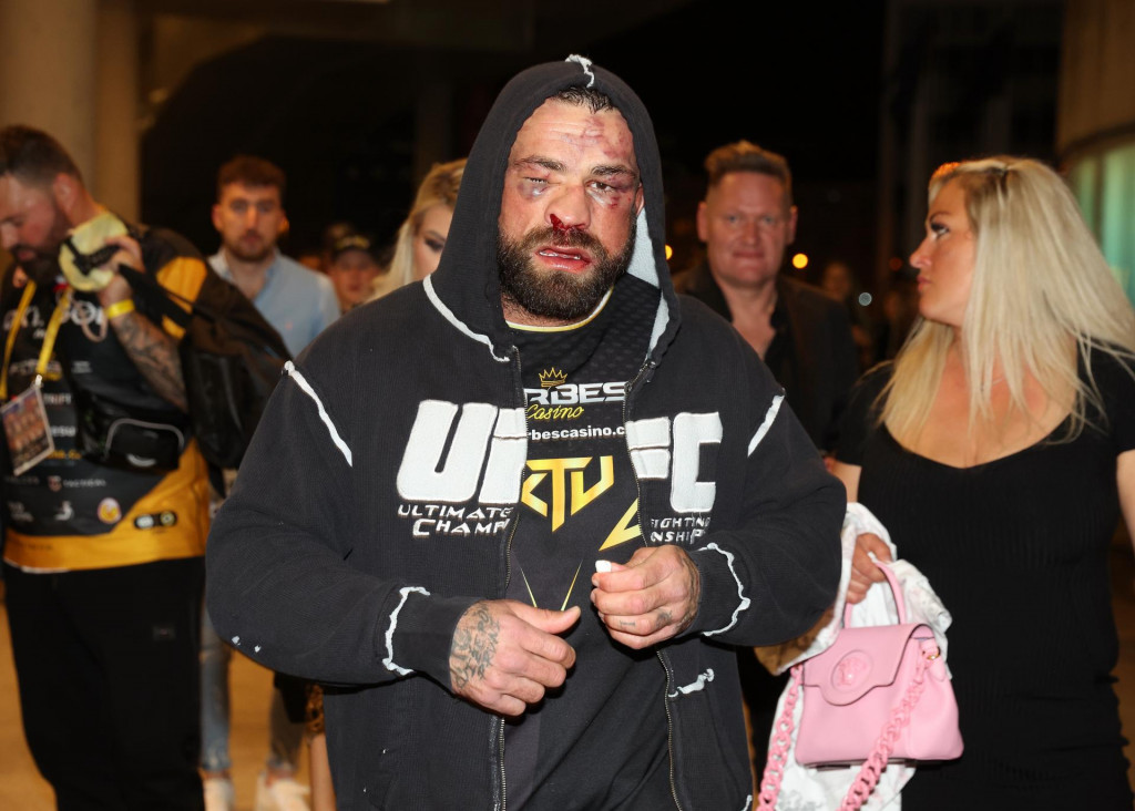 Karlos Termin&aacute;tor V&eacute;mola je zn&aacute;my svojou h&uacute;ževnatosťou.​