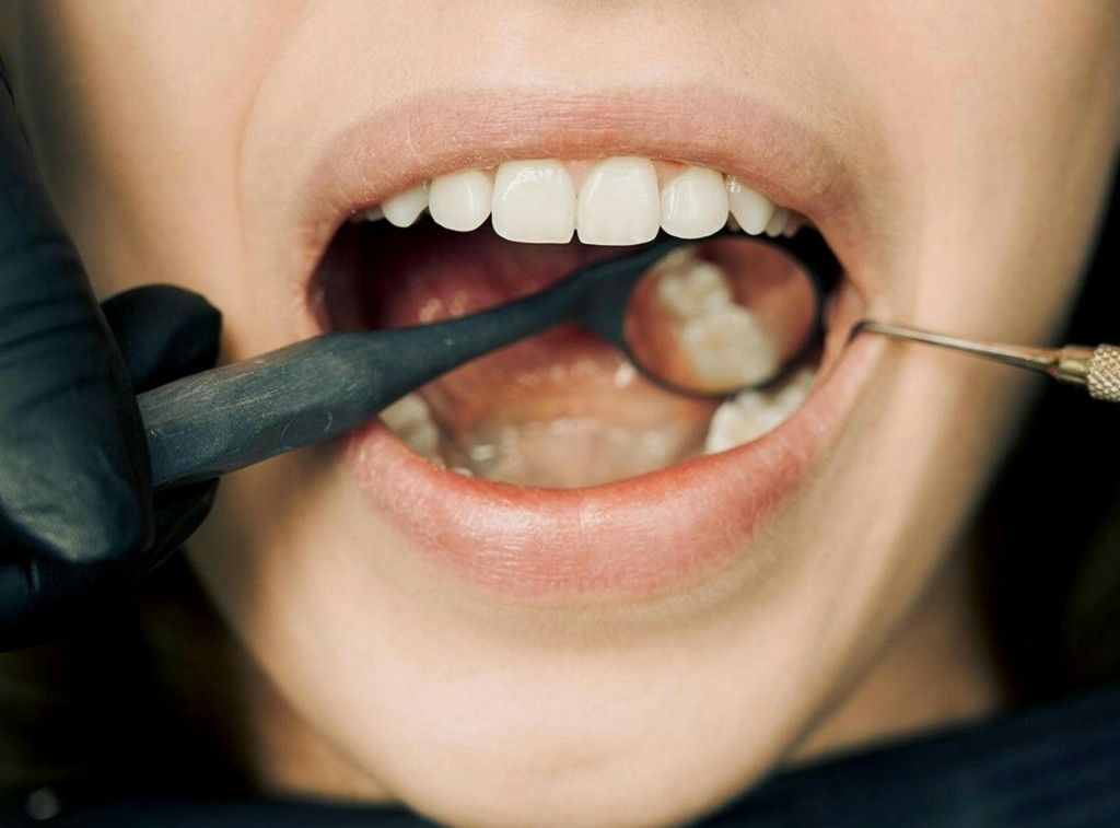 Čistenie zubov nie je len o peknom bielom &uacute;smeve.