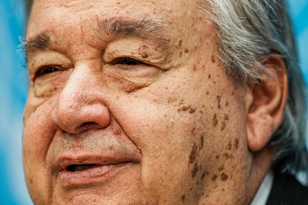 Gener&aacute;lny tajomn&iacute;k OSN Ant&oacute;nio Guterres. FOTO: REUTERS