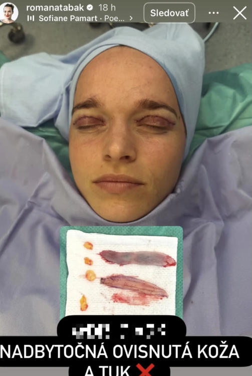 Romana Tabak after surgery.