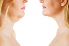 Dvojit&aacute; brada je zapr&iacute;činen&aacute; aj zl&yacute;m d&yacute;chan&iacute;m.