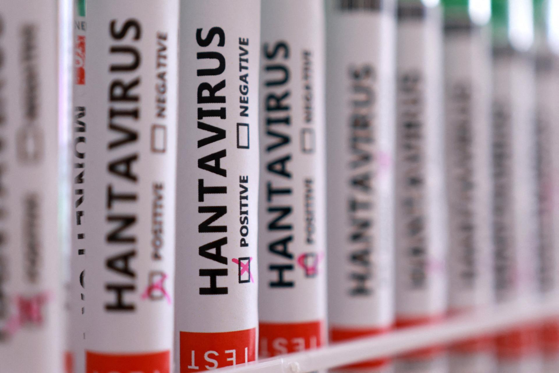 Na lodi sa šíril hantavírus. Úrady teraz hľadajú desiatky ľudí, ktorí vystúpili na Svätej Helene