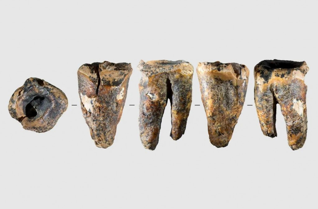 Neandert&aacute;lsky zub označen&yacute; ako Čagyrskaja 64 z piatich r&ocirc;znych uhlov.