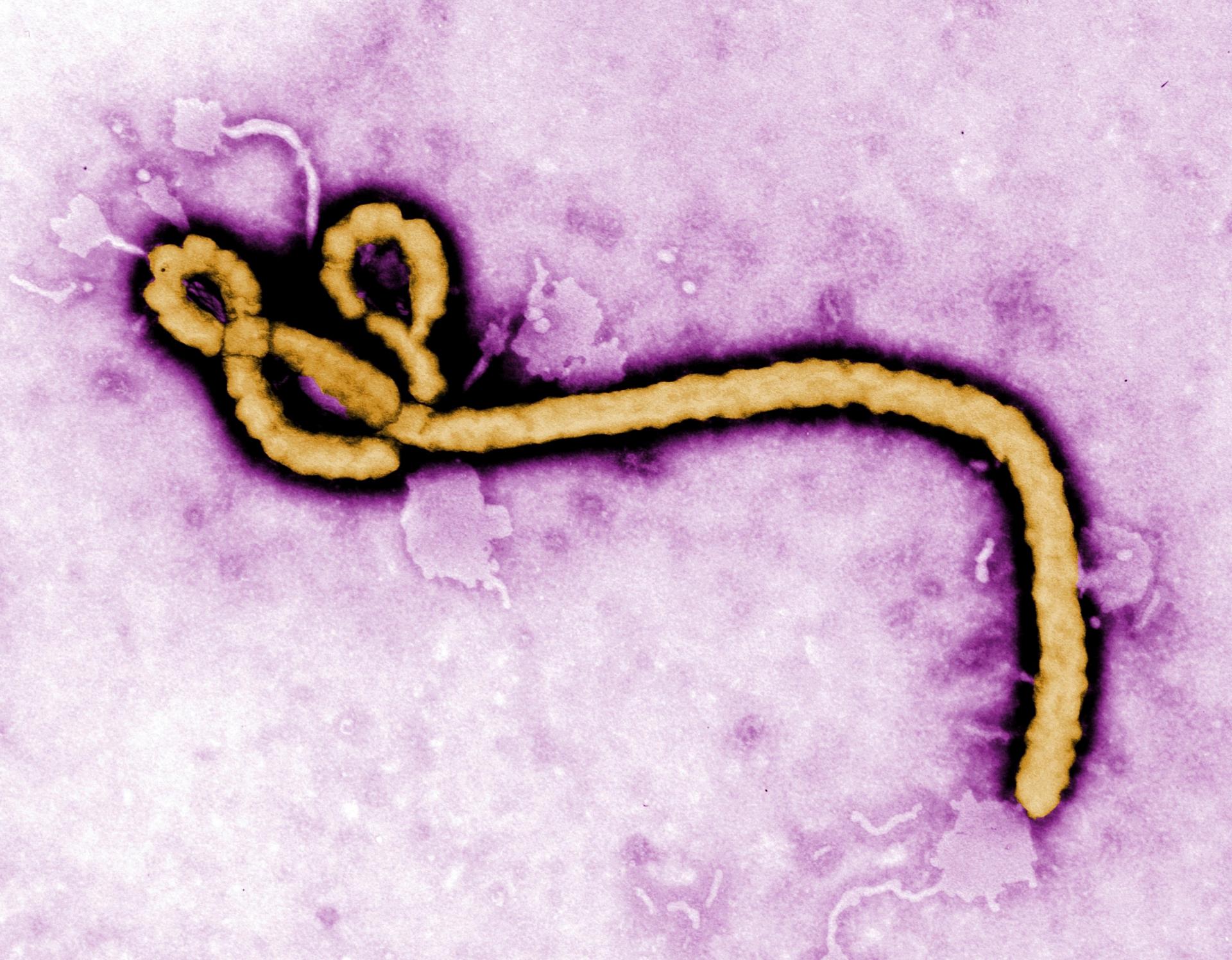 V Rakúsku je v izolácii človek s príznakmi možnej eboly, test to zatiaľ nepotvrdil