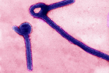 Transmisn&aacute; elektr&oacute;nov&aacute; mikroskopia zobrazuje častice v&iacute;rusu ebola. FOTO: Reuters/Lek&aacute;rsky v&yacute;skumn&yacute; &uacute;stav infekčn&yacute;ch chor&ocirc;b americkej arm&aacute;dy