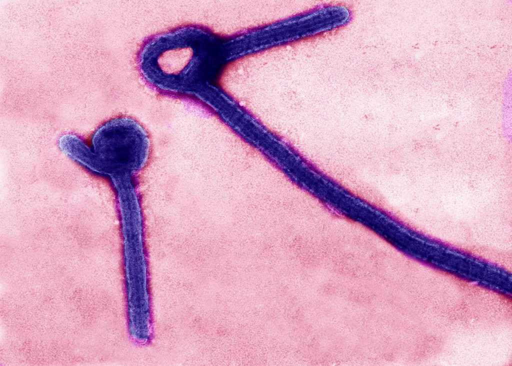 Transmisn&aacute; elektr&oacute;nov&aacute; mikroskopia zobrazuje častice v&iacute;rusu ebola. FOTO: Reuters/Lek&aacute;rsky v&yacute;skumn&yacute; &uacute;stav infekčn&yacute;ch chor&ocirc;b americkej arm&aacute;dy